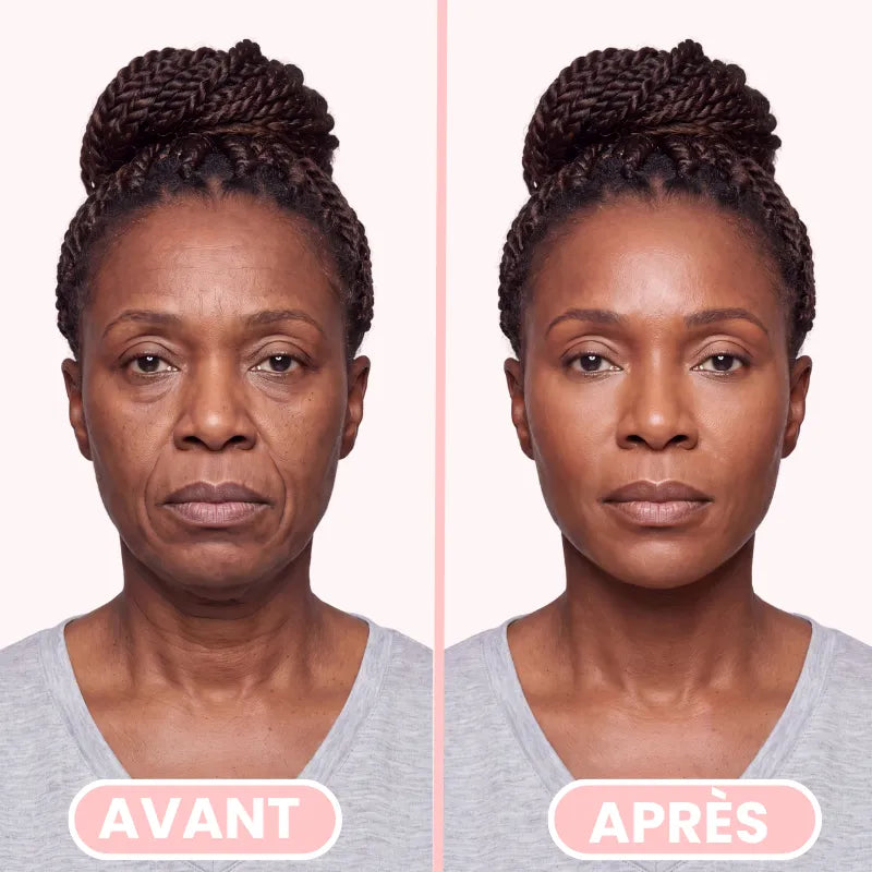 PureLift - Raffermisseur Visage & Mâchoire